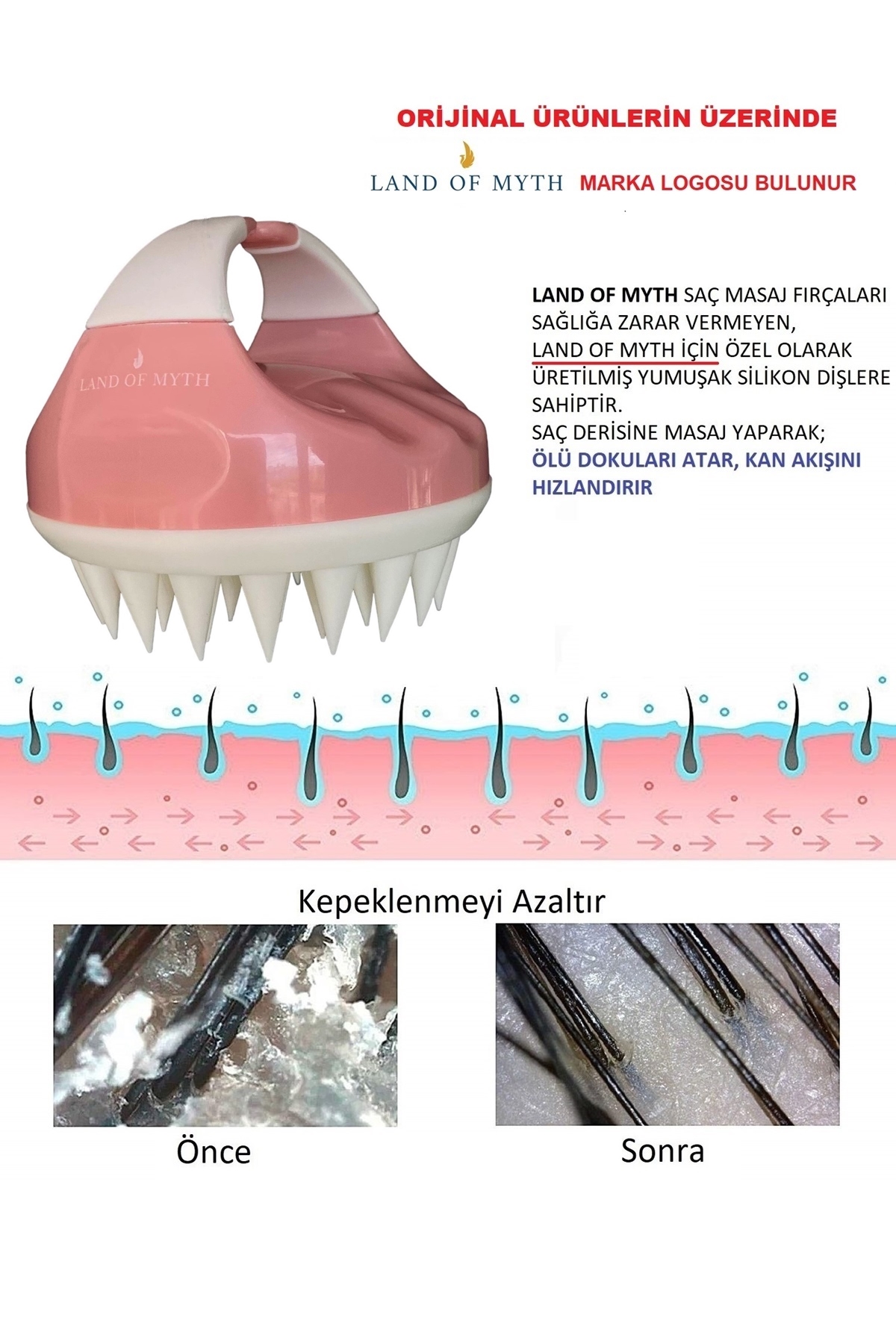 LOM1403 Yeni Yumuşak Silikon Dişli Saç Derisi Masaj Şampuan Duş Fırçası (Pembe-Beyaz)